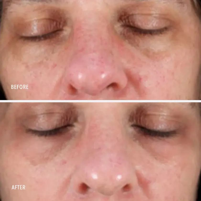 COLLAGEN REACTIVATE PM