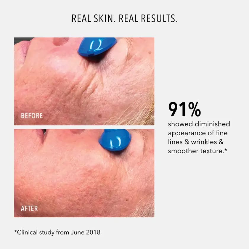 COLLAGEN REACTIVATE PM