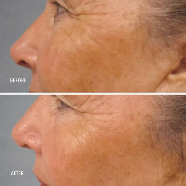 LumaPro-C Serum