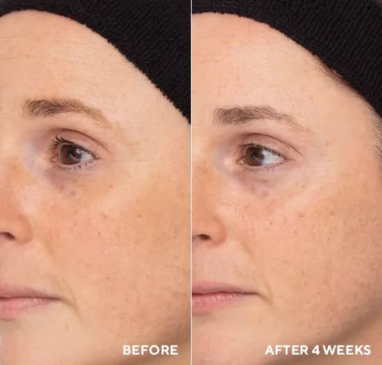 Retinol Routine Booster